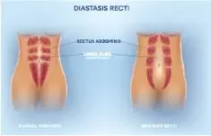 Six Physio