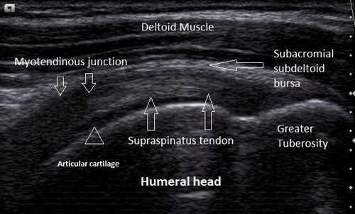 Deltoid Muscle